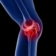 Navigating ACL Injuries: Understanding, Prevention, and Care in Elderly Population