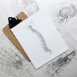 Understanding Lumbar Laminectomy: A Comprehensive Guide