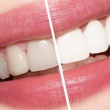 Cosmetic Dentistry: Enhancing Smiles Beyond the Dental Chair