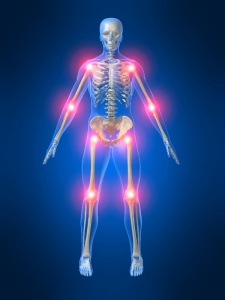 Common Joint Conditions