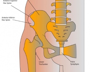 Sacroiliitis