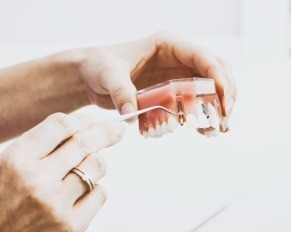 what are dental crowns