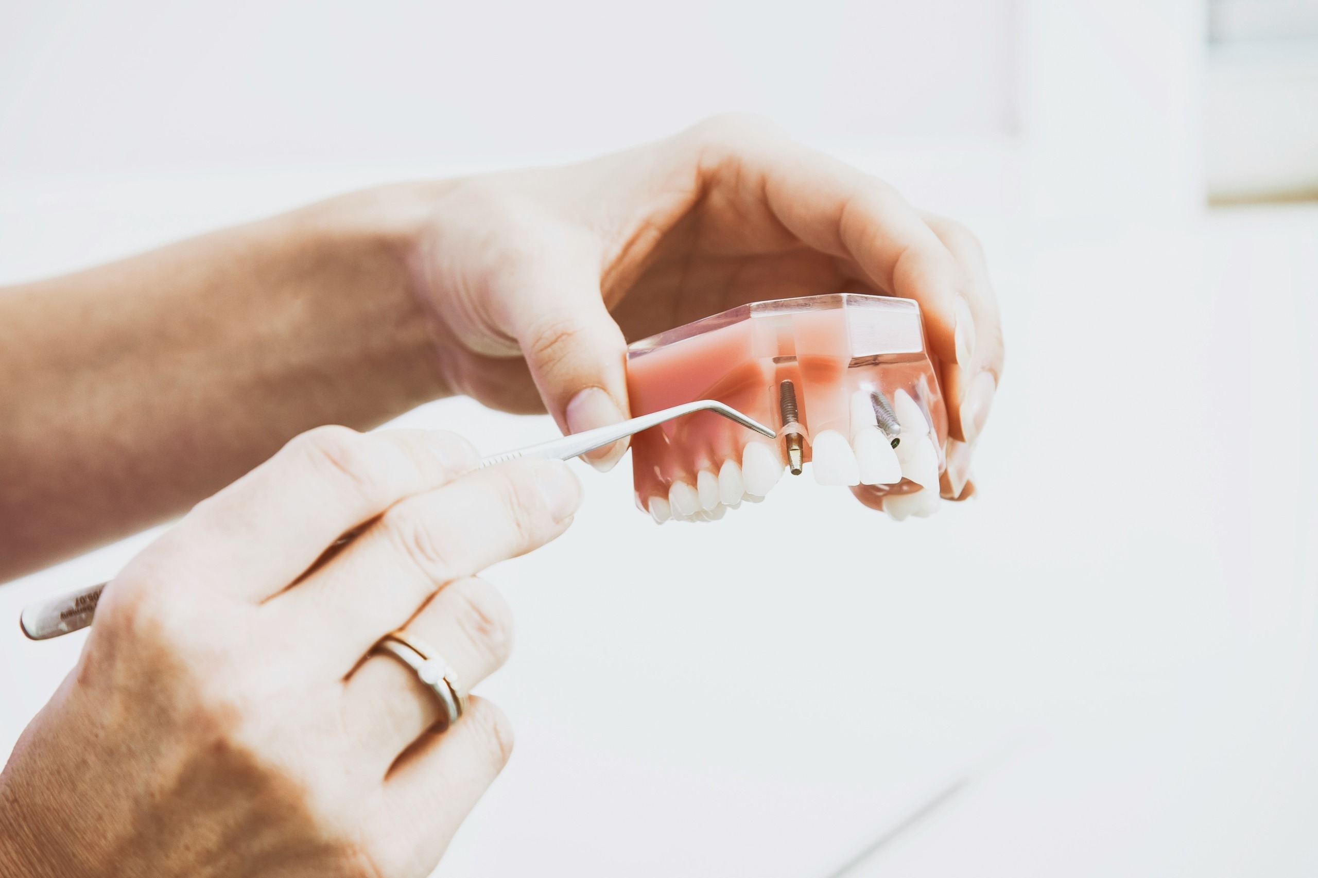 what are dental crowns