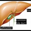 What are Gallbladder and Gallstones?