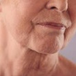 PDRN Toner for Post-Treatment Skin Recovery & Healing