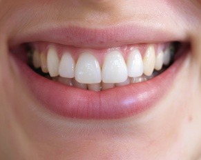 cosmetic dentistry