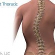 What is Idiopathic Scoliosis?