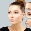 Cosmetic Botox Injections: What are they and what are the benefits?