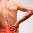 The Comprehensive Guide to Understanding Back Pain: Causes, Prevention, and the Role of Posture