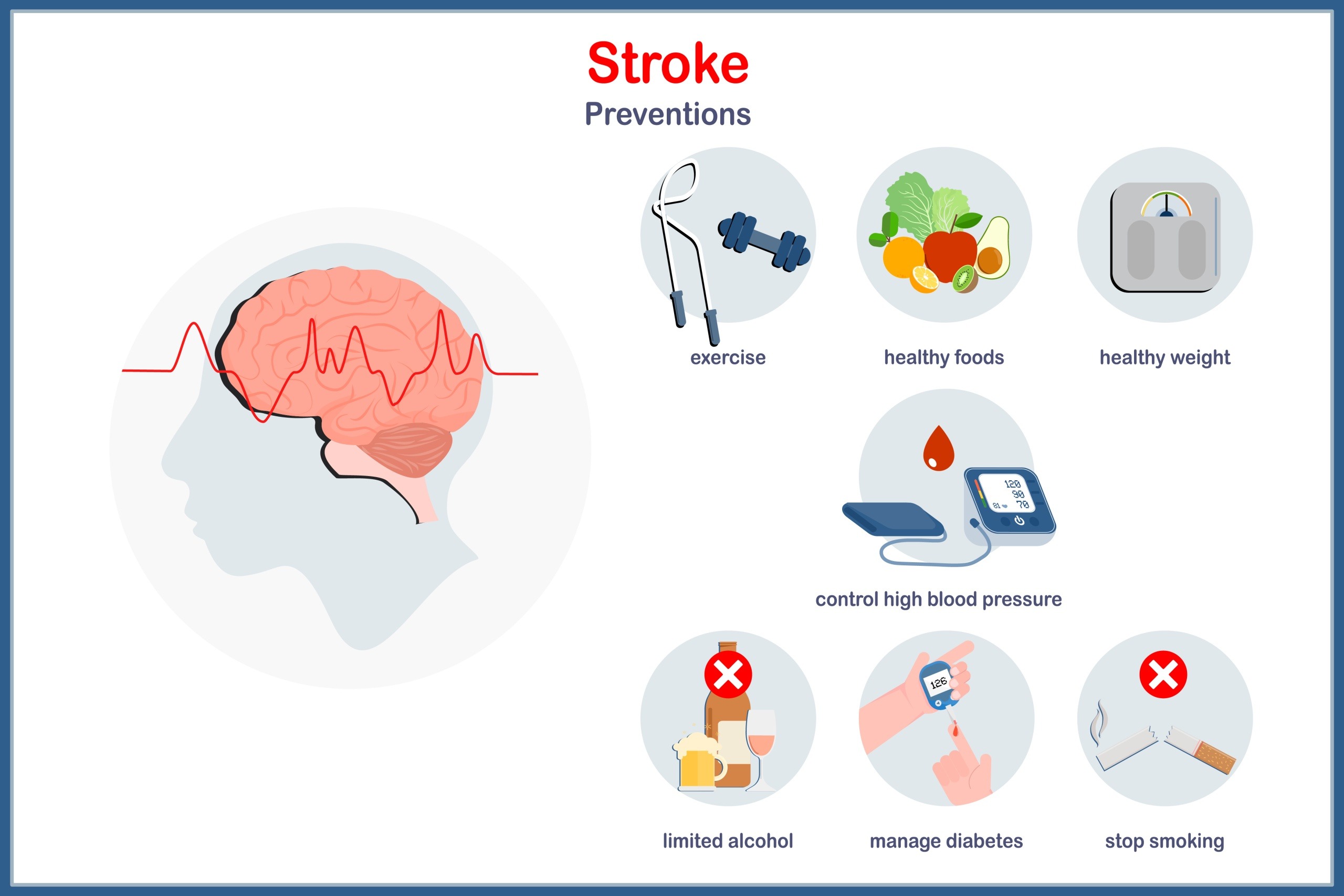 prevention of stroke