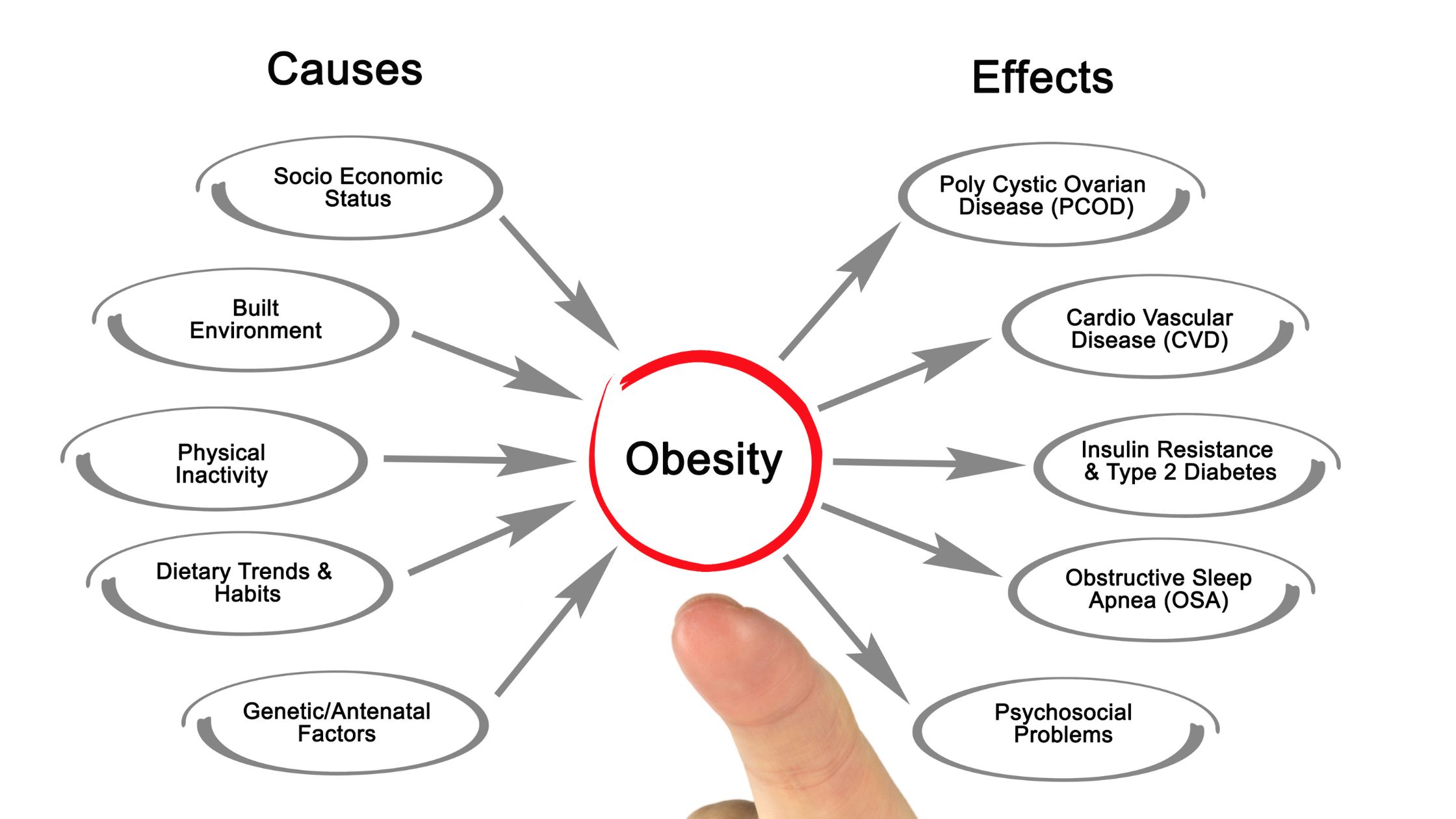 obesity causes