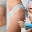 Why Is Miami the Best Place for Liposuction and BBL Recovery?