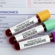 Pituitary Tumor Symptoms: When Vision and Hormone Changes Connect