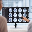 What Is a Craniotomy? What Actually Happens During Brain Surgery